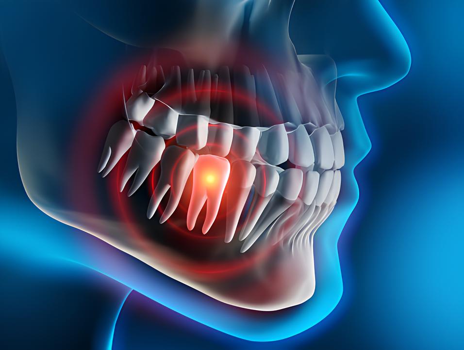 Teeth image - Emergency dentist Hitchin